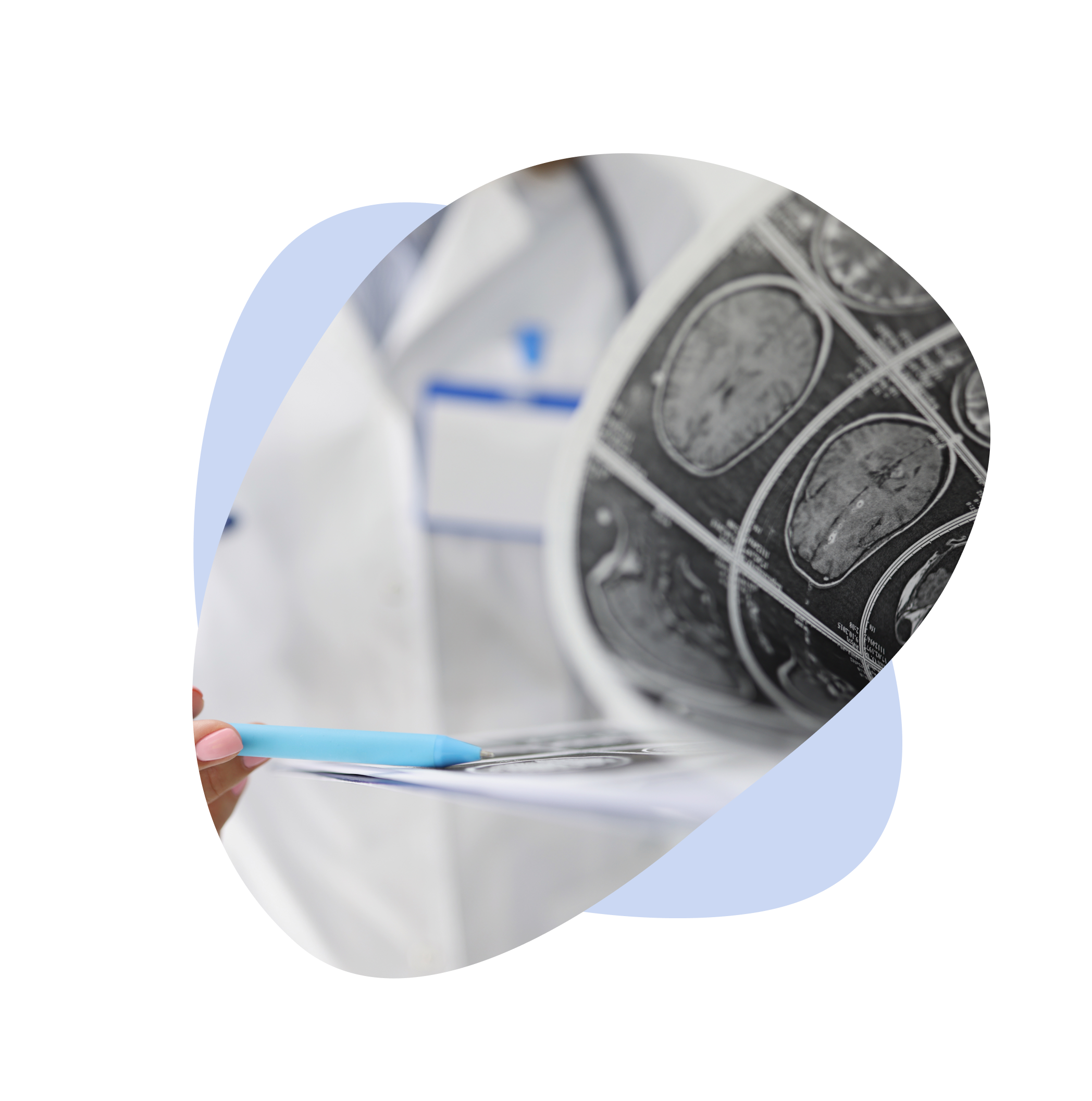 Doctor analyzing brain MRI scans in medical documentation